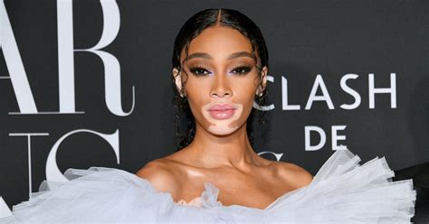 winnie harlow net worth|Here’s How Much Supermodel Winnie Harlow Is Worth Today